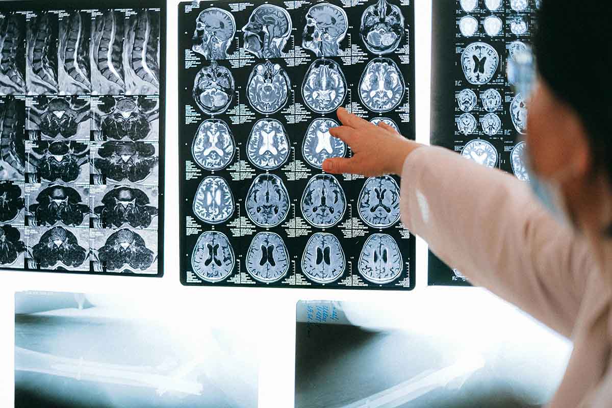 Private Neurologists in London: When to See One & What to Expect