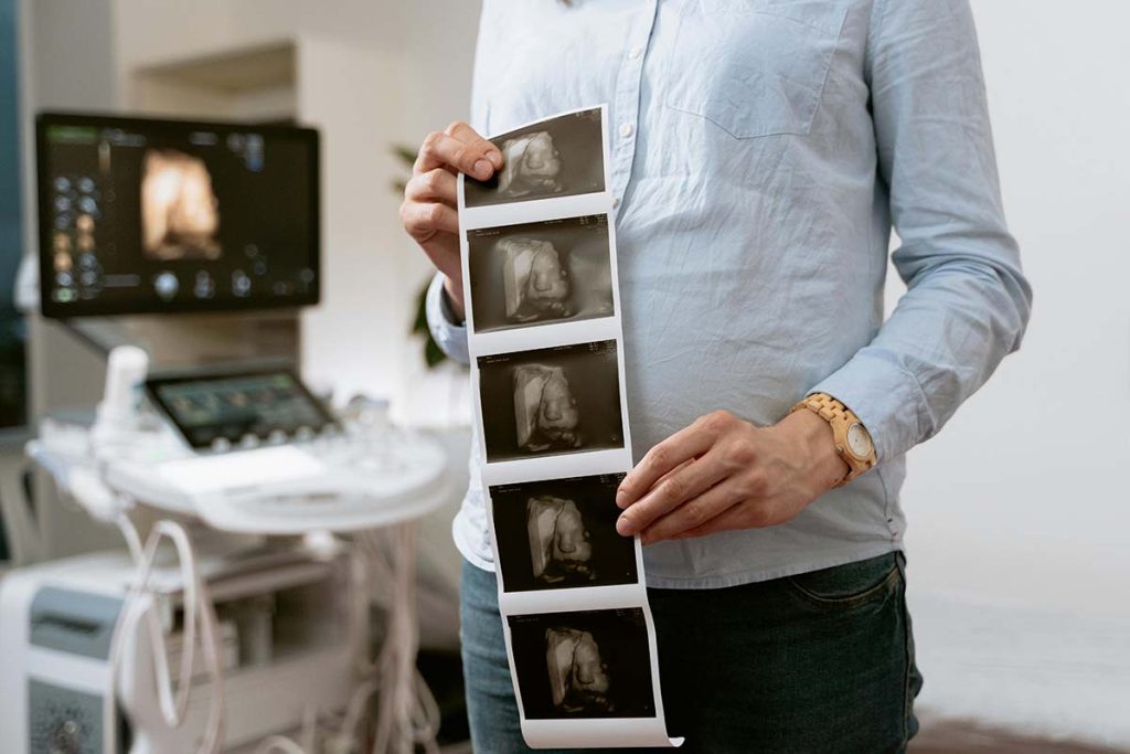 Expectant mother holding 3D ultrasound image of baby during late pregnancy scan in the clinic